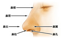 矯正駝峰鼻的方法有哪些