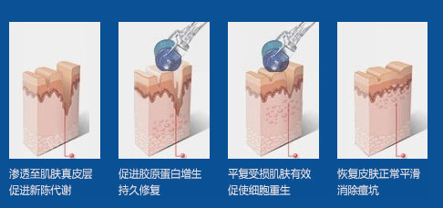  武漢美容一次多少錢?