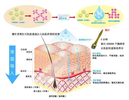 美塑除皺怎么樣