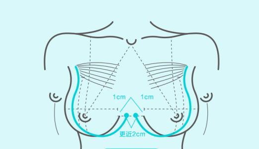 武漢豐胸術(shù)能改善乳房下垂嗎