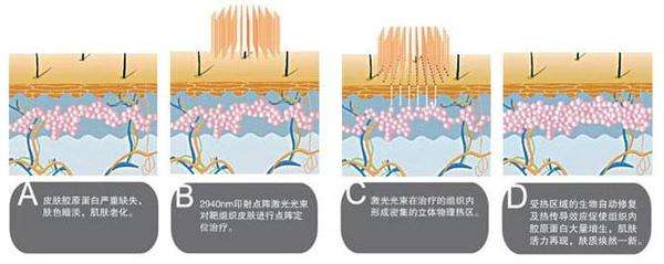 武漢影響祛痘價(jià)格的因素有哪些?顏值IN季