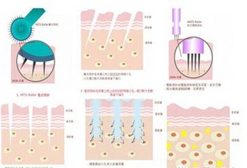 美塑有哪些作用?