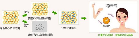 太陽穴凹陷怎么辦?