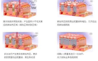 武漢激光祛斑大概要花多少錢?