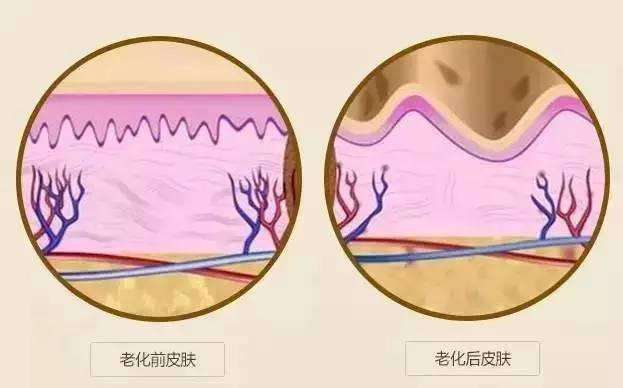 武漢臉上長皺紋怎么辦