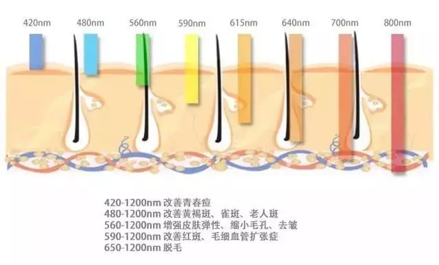 武漢光子嫩膚價格大概多少