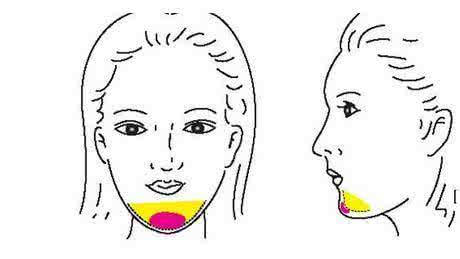 武漢假體隆下巴怎么選